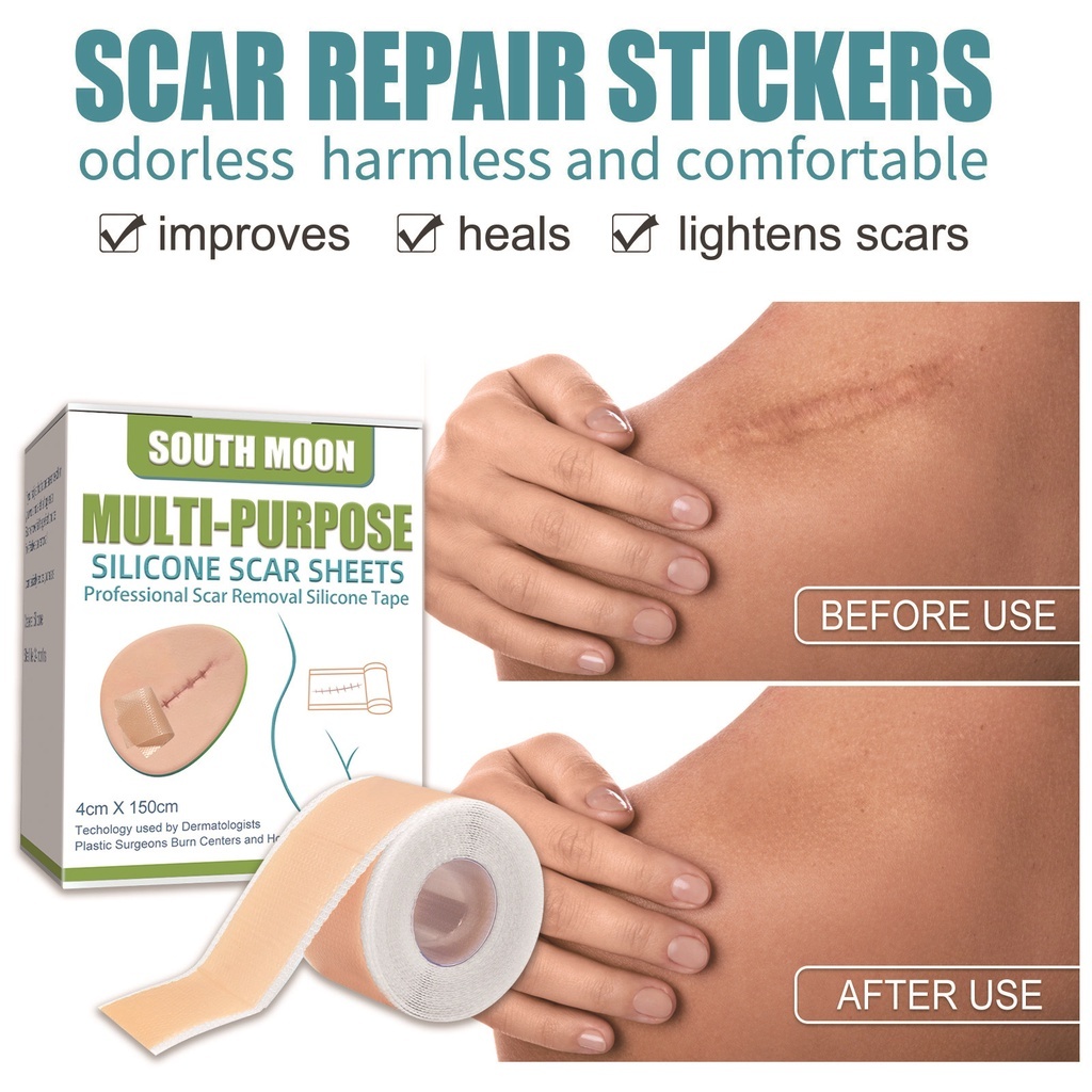 【🚚พร้อมส่ง】South Moon รักษารอยแผลเป็น แผ่นแปะแผลเป็น 4cm*150cm กําจัดรอยแผลเป็นจากแผลเ