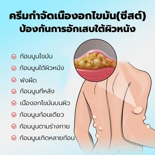 🔥ขายดี แท้ OUHOE🔥 ครีมทา ซี ส ก้อนไขมัน พร้อมส่งทั่ว ส่งไว ส่งฟรี