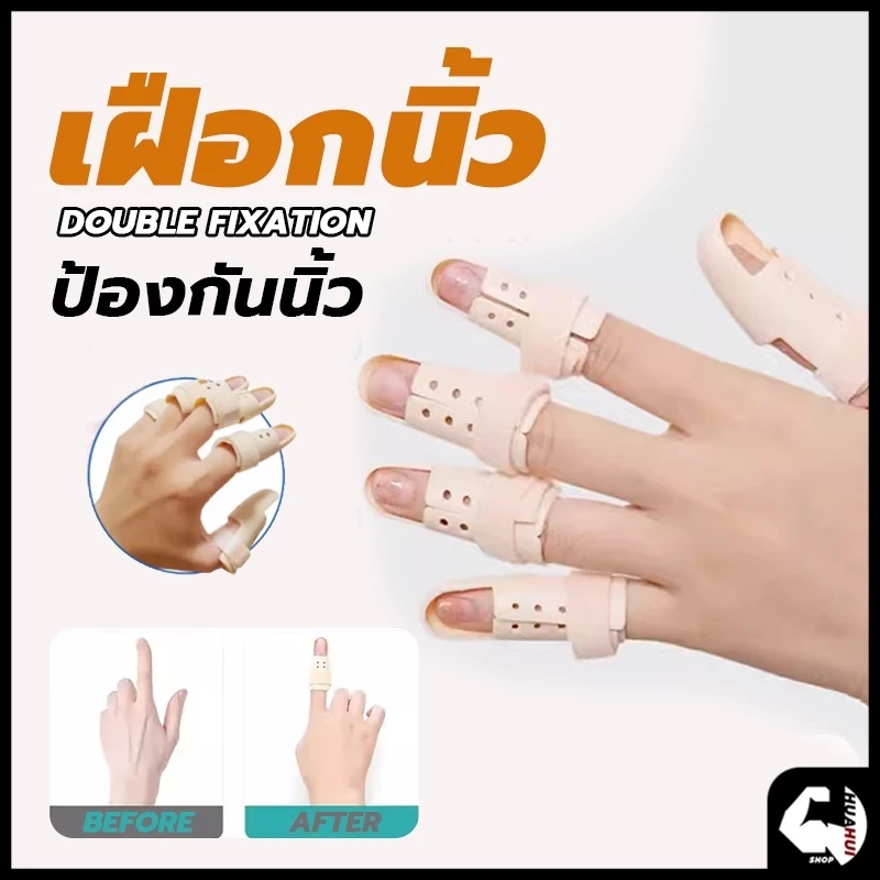 เฝือกนิ้ว mallet finger สำหรับนิ้วล็อค มือพลาสติกสีเนื้อ ป้องกันการงอข้อปลายนิ้ว ใช้ดามนิ้วสำหรับการรักษา