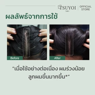 (4ขวด)ซึโยะอิ แฮร์ วอเทอรี่ เซรั่ม TSUYOI HAIR WATERY SERUM บำรุงผม ช่วยลดผมร่วง กระตุ้นการงอกใหม่ ลูกผม ชะลอการเกิดผมหง