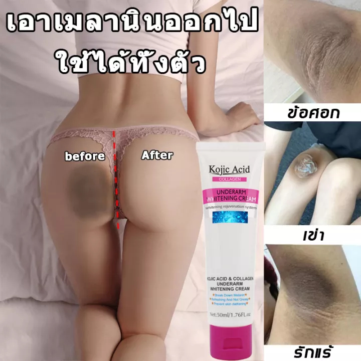 Kojic Acid ครีมคอลลาเจนไวท์เทนนิ่งไวท์เทนนิ่งสําหรับบํารุงรักแร้ใต้วงแขน