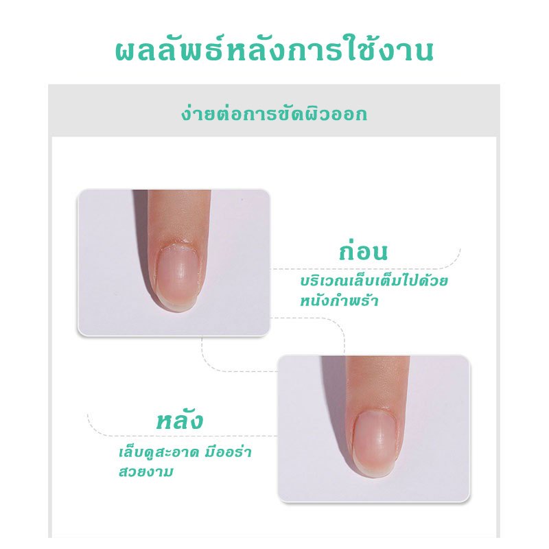อ่อนโยน ปลอดภัย น้ำยาตัดหนังเล็บ น้ำยาหนังนุ่ม ครีมตัดหนัง น้ำยาหนังนุ่ม ตัดหนัง ครีมตัดหนังเล็บ - รูปที่ 2