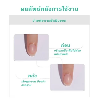 อ่อนโยน ปลอดภัย น้ำยาตัดหนังเล็บ น้ำยาหนังนุ่ม ครีมตัดหนัง น้ำยาหนังนุ่ม ตัดหนัง ครีมตัดหนังเล็บ