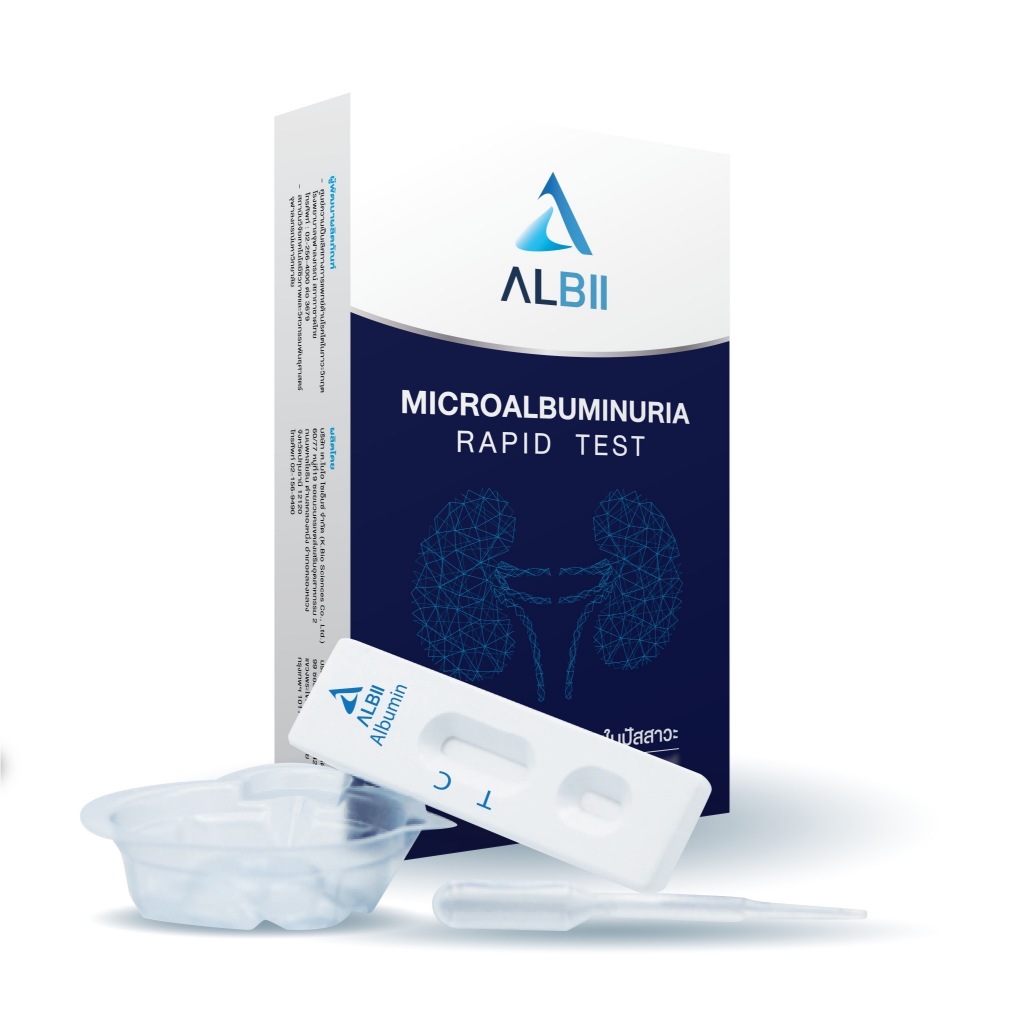 ALBII ชุดตรวจค่าไต งานวิจัยจากจุฬาลงกรณ์มหาวิยาลัย