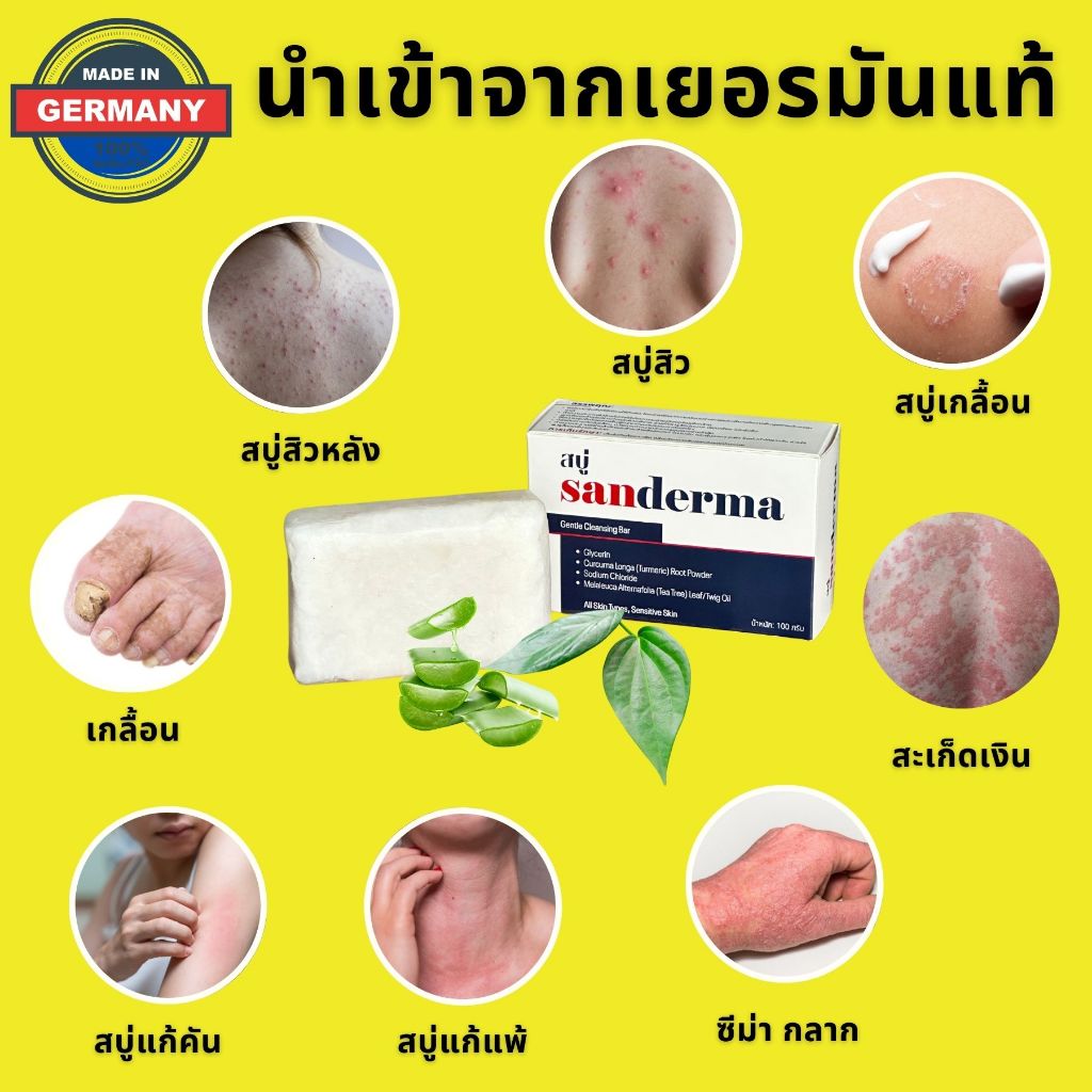 สบู่แก้คัน Sanderma 50 กรัม สบู่สิว สบู่สิวหลัง สบู่สมุนไพร สบู่เกลื้อน
