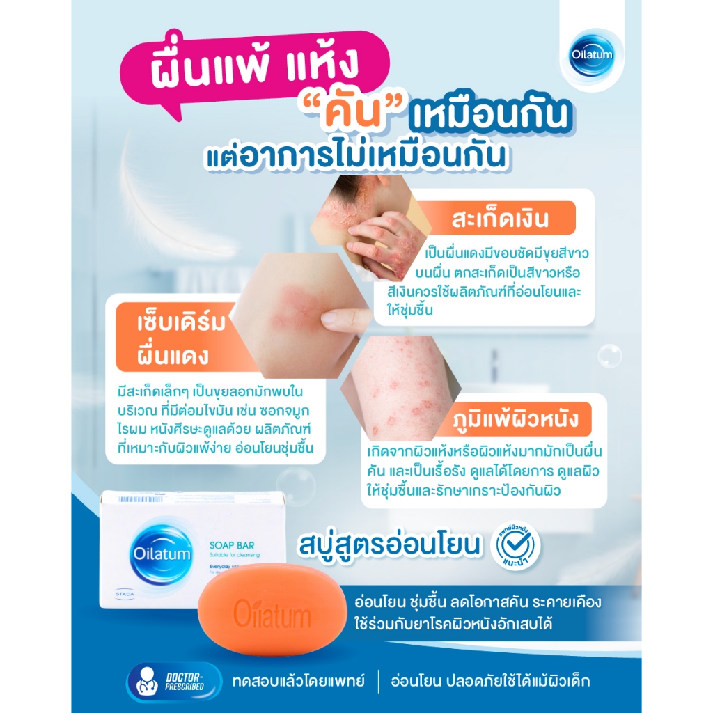 (สุดคุ้ม แพ็ค3) Oilatum  สบู่ทางการแพทย์ เติมความชุ่มชื้นลดคัน สำหรับผิวแพ้ แห้ง ลอก คัน สะเก็ดเงิน & เซ็บเดิร์ม 100gx3 - รูปที่ 2