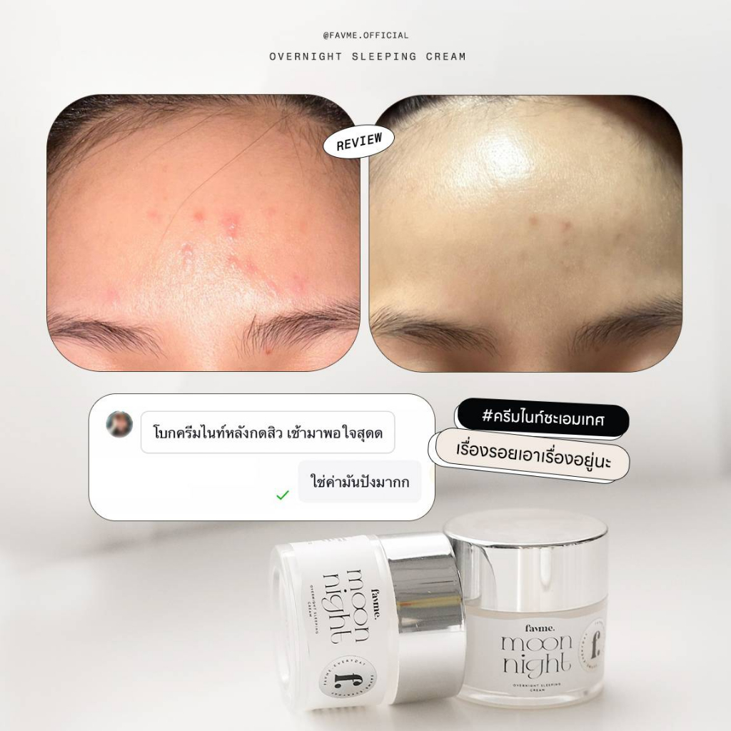 Lovelist เซตลดรอย เซรั่ม Fully Shine + ครีม Moon Night Cream - รูปที่ 4