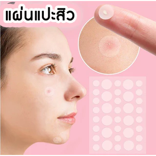 Salicylic Acid แผ่นแปะสิว ช่วยลดอาการอักเสบให้ยุบไว ช่วยดูดสิว รักษาสิว ขอบบาง กันน้ำ แต่งหน้าเนียน