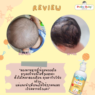 แพคคู่สุดคุ้ม ซือคู่ถูกกว่า 2 ขวด