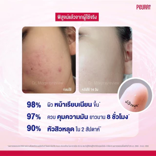 PEURRi Acne Cleanser เจลล้างหน้าสำหรับคนเป็นสิว 250ml.
