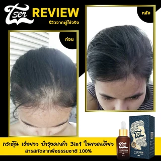 [ส่งฟรี] เซรั่มปลูกคิ้ว T-Ser บำรุงขนคิ้ว ที่ปลูกคิ้วดก น้ำยาปลูกคิ้ว (2ขวด)