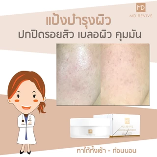 MD REVIVE SENSITIVE LOOSE POWDER แป้งฝุ่น ลดสิว คุมมัน ลดสิวอุดตัน แป้งเบลอผิว ปกปิดมากกว่าแป้งฝุ่นโปร่งแสง สูตรอ่อนโยน