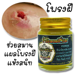 โปร 1 แถม 1 ซื้อเลย ชุดกำจัดฝีทุกชนิดครีมบาล์มและสบู่ ดูแลป้องกันเเละยับยั้งฝีหนอ งเนื้อครีมโลชั่นนุ่นเป็นมิตรต่อผิวหนัง