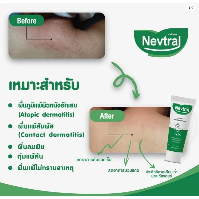 Nevtral cream สารสกัดจากธรรมชาติสําหรับผื่นแพ้และแมลงสัตว์กัดต่อย - รูปที่ 2