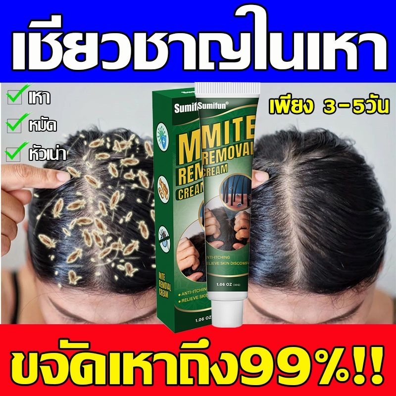 กำจัดเหาอย่างรวดเร็ว แชมพูกำจัดเหา ยาฆ่าเหา กำจัดเหาและไข่ แก้คัน กลิ่นหอม อ่อนโยน เด็กใช้ได้ผู้ใหญ่ใช้ดี