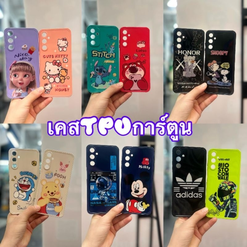 เคสTPUกันกระแทกลายการ์ตูนน่ารัก รุ่น WiKo Sunny5 U10 U20 พร้อมจัดส่ง