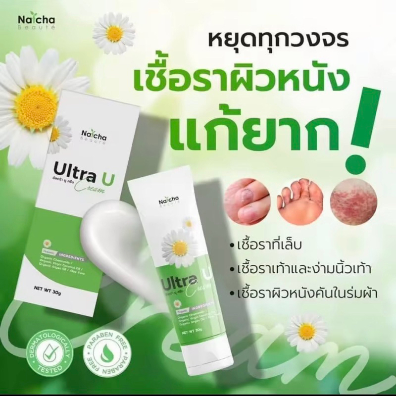 NATCHA BEAUTE อัลตร้ายู ครีมเชื้อรา เหมาะสำหรับผิวแพ้ง่าย พร้อมส่ง