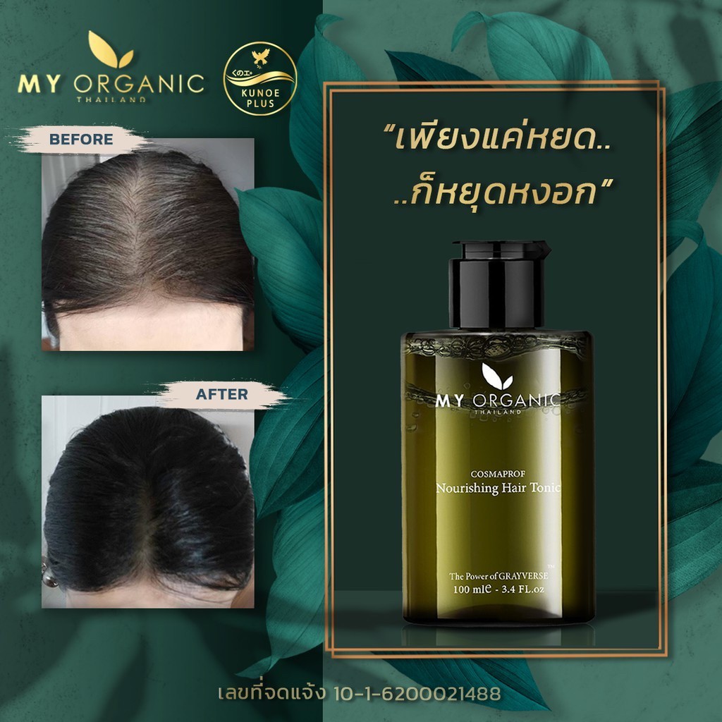 [สูตรใหม่+โปรโมชั่น] My organic Hair tonic ออร์แกนิคโทนิค เซรั่มบำรุงผม ลดผมหงอก ผมร่วง - รูปที่ 3