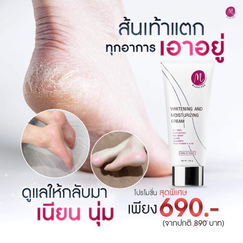 Migacare 1 หลอด ไมก้าแคร์ ครีมทาเท้าแตก รักษาเท้าแตก บำรุง เท้า มือ ให้ชุ่มชื้น