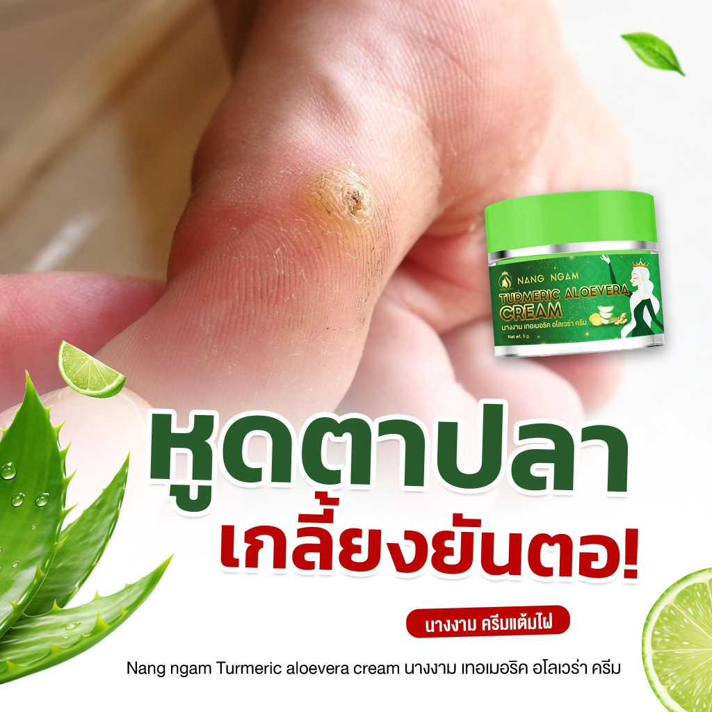 ครีมแต้ม ไฝ ครีมไฝ นางงาม ขี้แมลงวัน หูด ตาปลา ติ่งเนื้อ ครีมกำจัด ไฝ ครีมแต้มไฝ แต้มไฝ ทาไฝ – โปรปัง