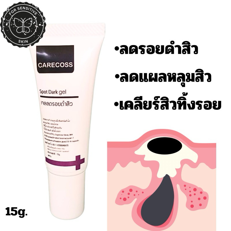เจลลดรอยดำสิว 15 กรัม สูตรคลีนิก