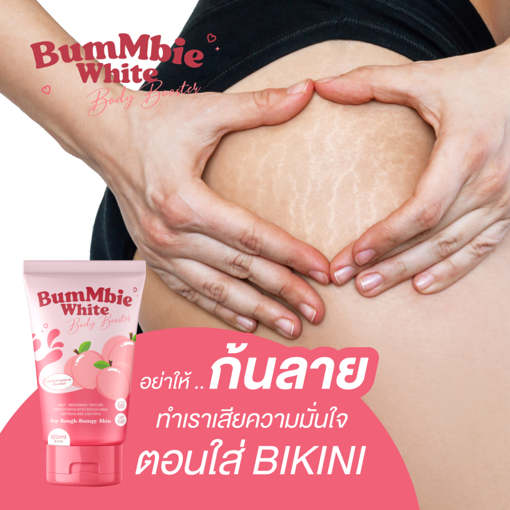 1 แถม 1 | BumMbie บัมบี้ไวท์ ครีมทาก้น รอยแตกลายงา รอยดำ รอยแผลเป็นน้ำเหลือง ขาลาย ผดตุ่มสิว 100 ml