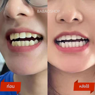 [พร้อมส่ง] ฟอกฟันขาว ชุดใหญ่ จัดเต็ม พร้อมเจลฟอกฟันขาว สูตรดีที่สุดถึง 3 หลอด อุปกรณ์ครบชุด
