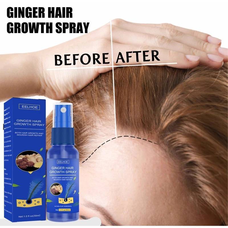 สเปรย์ปลูกผมสมุนไพร EELHOE Ginger Hair Growth Spray มีส่วนผสมของขิง ช่วยบำรุงรากผมช่วยให้เส้นผมงอกขึ้นใหม่ ดกดำ