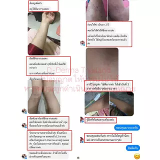 (ของแท้!!) ครีม D-Derma ผลิตภัณฑ์ธรรมชาติ โดยเภสัชกร