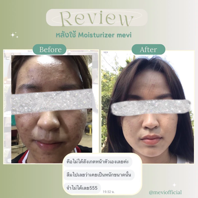 Mevi Moisturizer เมวี่มอยซ์เจอร์ไรเซอร์ 30g thumbnail 7
