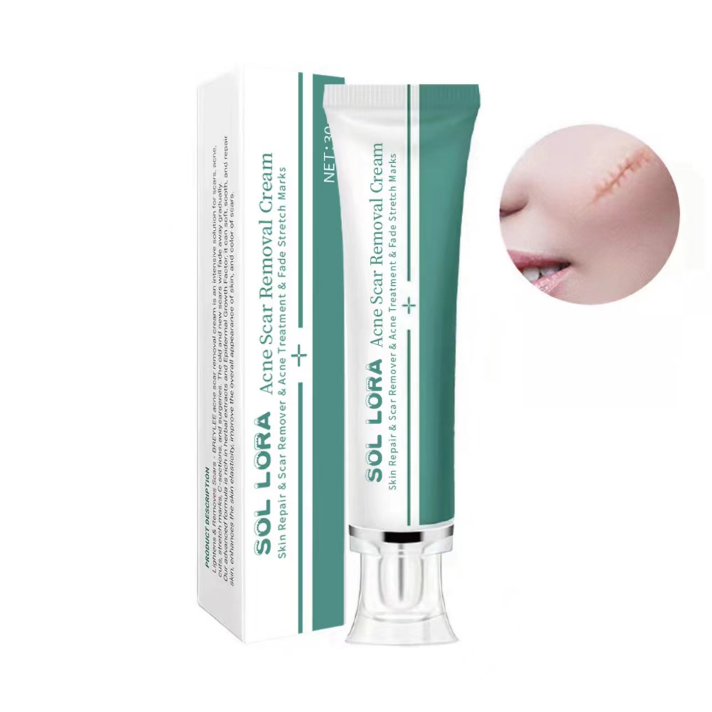 *4uh2xd4n6a*scar gel 30g.SOL LORA ครีมลบแผลเป็น แผลเป็นนูน ครีมรอยแผลเป็น ลดแผลคีรอย ครีมลบรอยเเผลเป็น