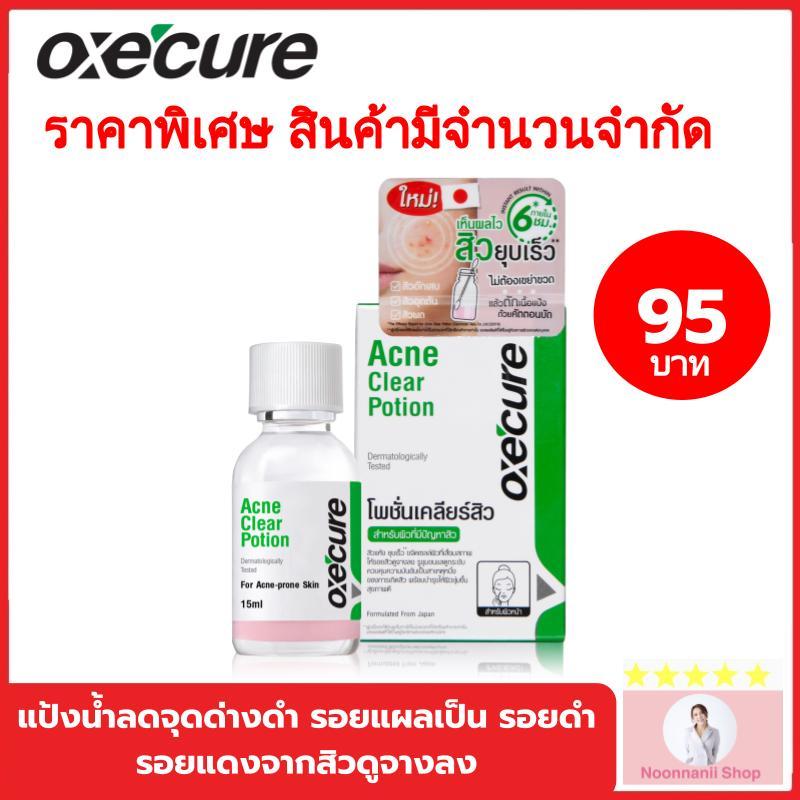 Oxe cure acne clear potion 15 ml. ( สีเขียว ) / Oxe cure Dark Spot Clearing Potion 15 ml. ( สีม่วง )