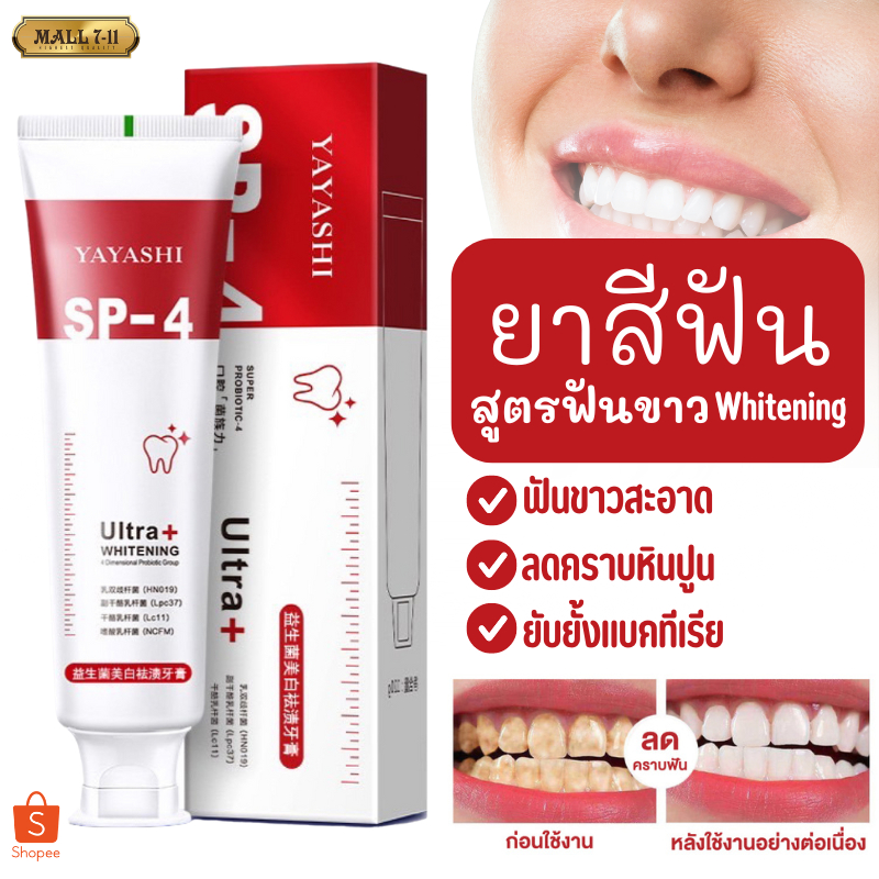ยาสีฟัน ยาสีฟันฟันขาว ยาสีฟันโปรไบโอติก ลมหายใจสดชื่น และดูแลช่องปาก