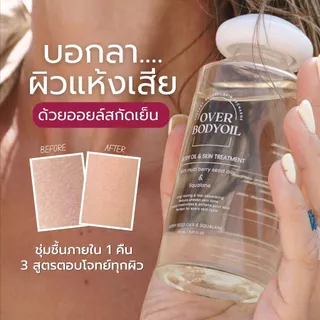 Overnaked - Over body oil บอดี้ออยล์บำรุงผิวนุ่มชุ่มชื้น 150 ml. ลดรอยแตกลาย ปลอบปะโลมผิวให้สุขภาพดี