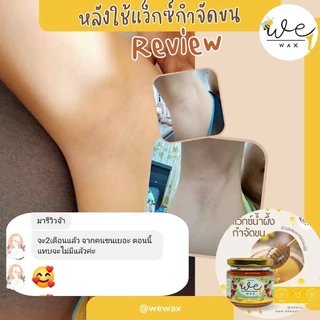 แว็กซ์​น้ำผึ้ง100g. แว็กกำจัดขน​ แว็กขนขา​ ขนแขน ขนหมออ้อย ขนรักแร้ (สำหรับขนหนา) พร้อมอุปกรณ์​​ขนาด
