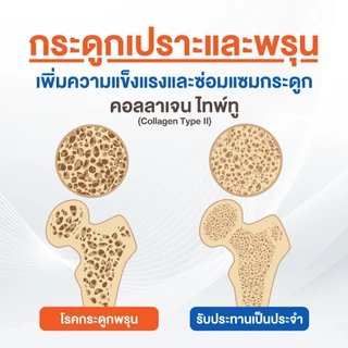 Calcium ขนาด 90 เม็ด 3 ขวด ราคาพิเศษ ซอฟต์เจล fish oil แคลเซียม collagen type ii คอลลาเจน บำรุงกระดูกและข้อต่อ