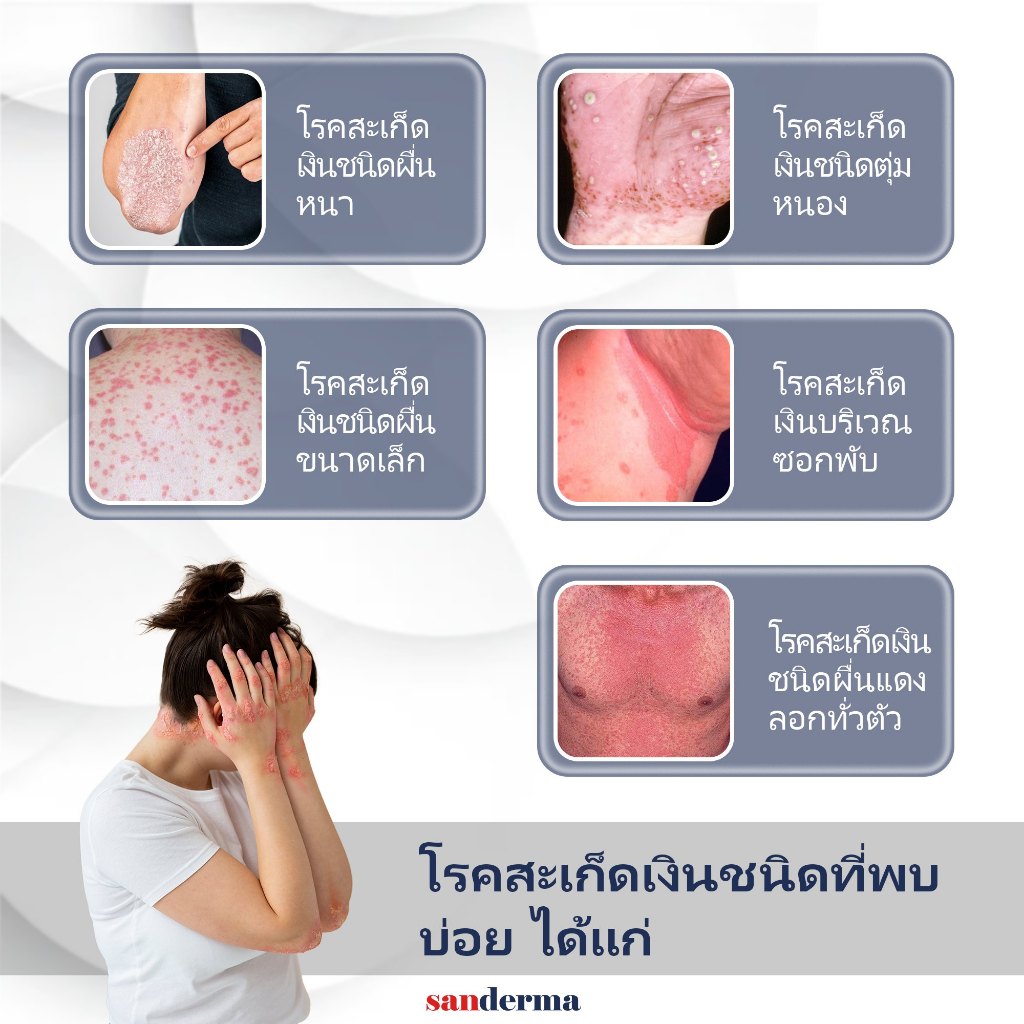 COMBO ทาแก้คัน SANDERMA CREAM และ SERUM SANDERMA - รูปที่ 3