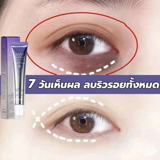 ครีมบำรุงรอบตา 20g ดูแลรอบดวงตาและ ครีมลดถุงใต้ตา ลดรอยคลำ้ใ…