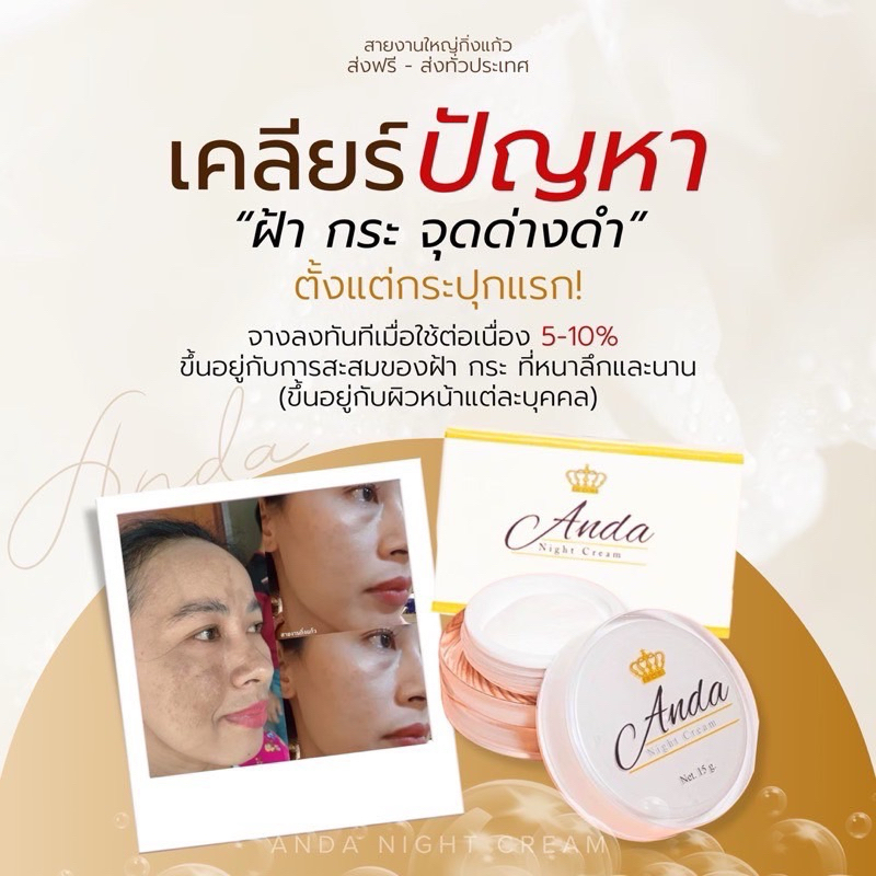 อันดาไนท์ครีม ครีมลดฝ้า กระ รอยดำจากสิว(ครีมอันดา) AndaNightCream ของแท้ มีราคาส่ง ขายดีมาก