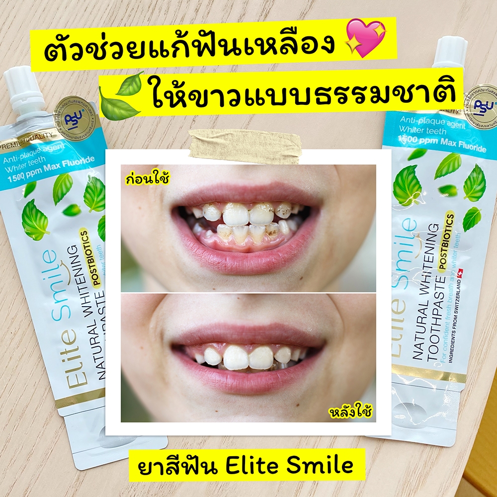 [แบบซอง] Elite smile ยาสีฟันสูตรฟันขาว แก้ปัญหาโรคเหงือก ร้อนใน กลิ่นปาก ขนาด 10 กรัม 8 ซอง