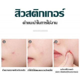 แผ่นสติกเกอร์ไฮโดรคอลลอยด์ กันน้ํา สีม่วง หลากสีสัน สําหรับติดสิวเสี้ยน มี 28 ชิ้น