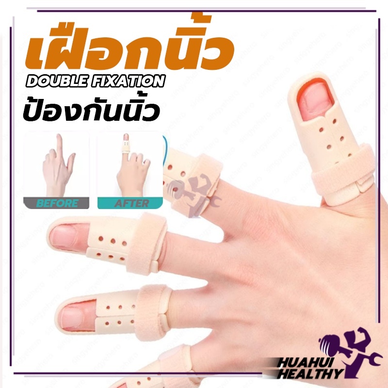 เฝือกนิ้ว mallet finger ป้องกันการงอข้อปลายนิ้ว มือพลาสติกสีเนื้อ สำหรับนิ้วล็อค ใช้ดามนิ้วสำหรับการรักษา