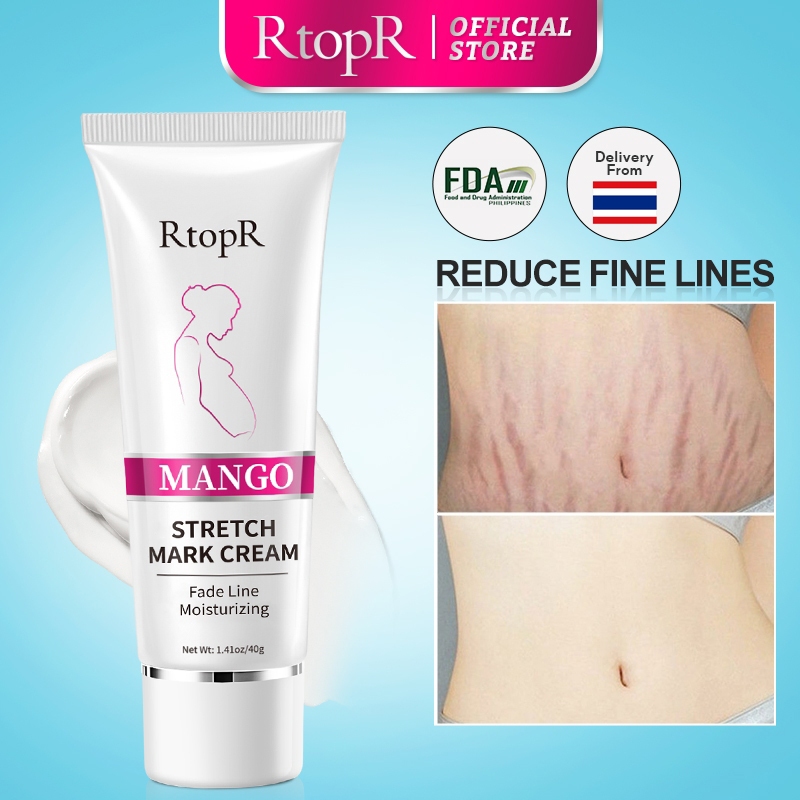 RtopR FDA มะม่วงครีมบํารุงผิว ครีมทาท้องลาย แก้ท้องลาย ลดรอยแตกลาย ขาแตกลาย สะโพกลาย​ ผิวลาย 40 กรัม
