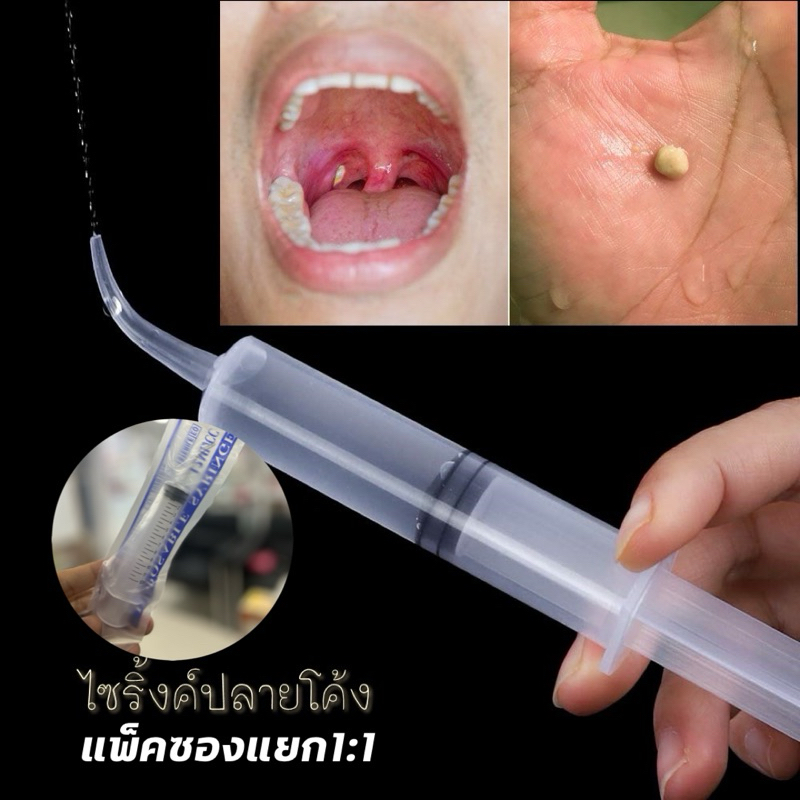 ไซริงค์กำจัดนิ่วทอนซิล tonsil stone ไซริ้งค์ปลายโค้ง Dental irrigation syringe  ความจุ 12 มล.แพ็คซอง