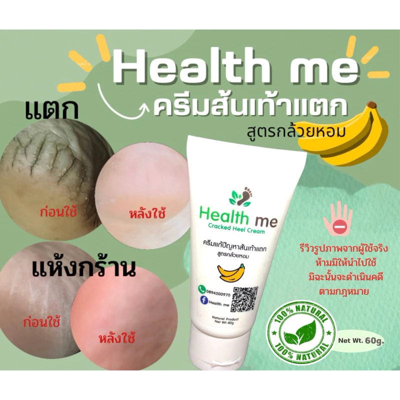 ✅ได้ผลจริง✅ครีมส้นเท้าแตก Health me ใช้จริง หายชัวร์