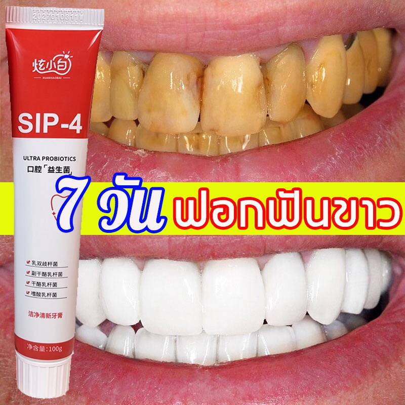 1 แถม 1ยาสีฟันแก้ฟันเหลืองดับกลิ่นปาก ยาสีฟันไวท์เทนนิ่ง ดูแลช่องปาก ฟอกฟันขาว sp 4