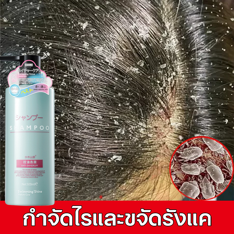 แชมพูแก้คัน ยาสระผม ยาสระผมขจัดรังแค 500ml ยาสระผมผมร่วง แชมพูขจัดรังแค ควบคุมความมัน ขจัดรังแค ลดผมร่วง บํารุงรากผม
