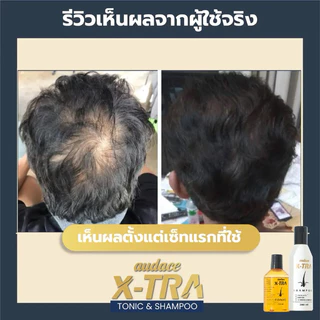 ออด๊าซ เอ็กซ์ทร้า โทนิค สำหรับเส้นผมที่หลุดร่วงง่าย (New Procapil,Biotin)กล่องทอง 200 ml. (หมดอายุปี2028)