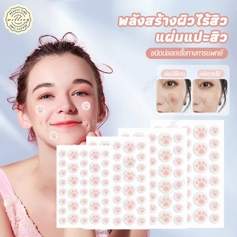 แผ่นสติกเกอร์แปะสิว แผ่นสิว สําหรับติดตกแต่งสิว แผ่นแปะดูดสิว แผ่นดูดสิว น่ารักแผ่นแปะสิว น่ารัก