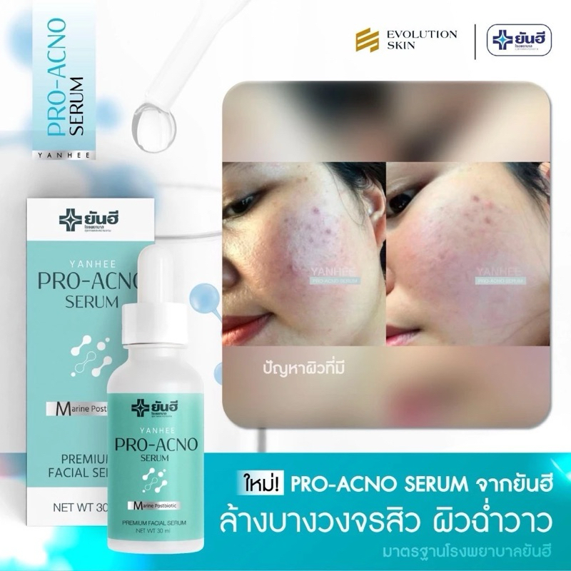 ยันฮี pro acno serum ของแท้1000%